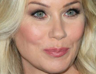Christina Applegate get infection